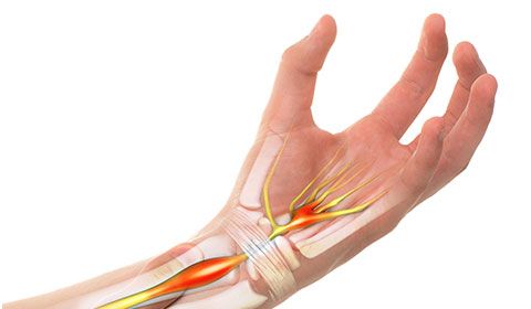 image of median nerve and hand anatomy