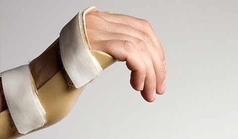 wrist with splint to restrict movement