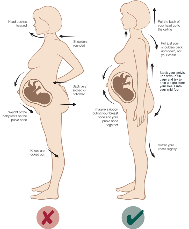 Butt Pain During Pregnancy: How to Cope