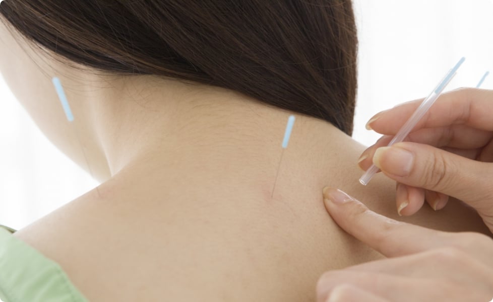 Acupunture Banner