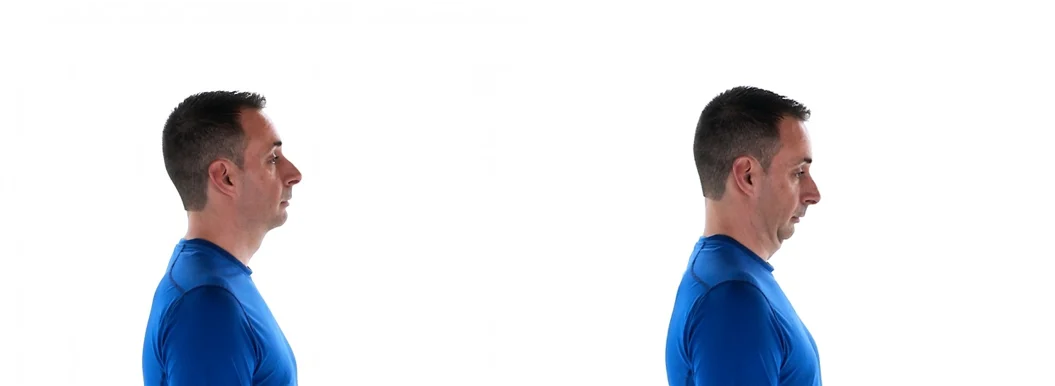 Man performing chin tucks exercises for neck tension