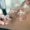 Cupping